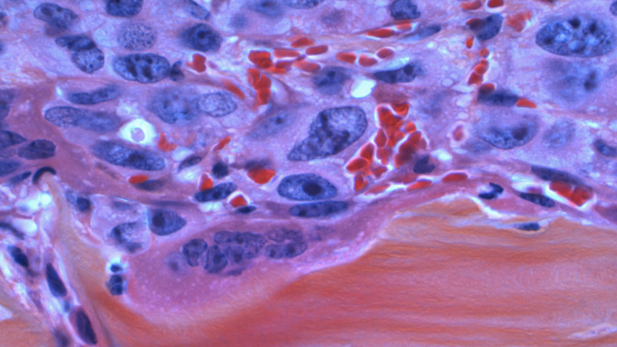 Studienkonzept Onkologie: Mikroskopaufnahme von Krebszellen – National-cancer-institute-SP2C8o2EZBw | Foto Copyright by unsplash.